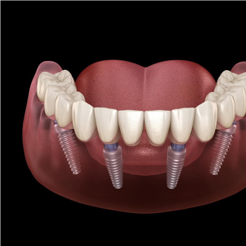 Dental Treatment