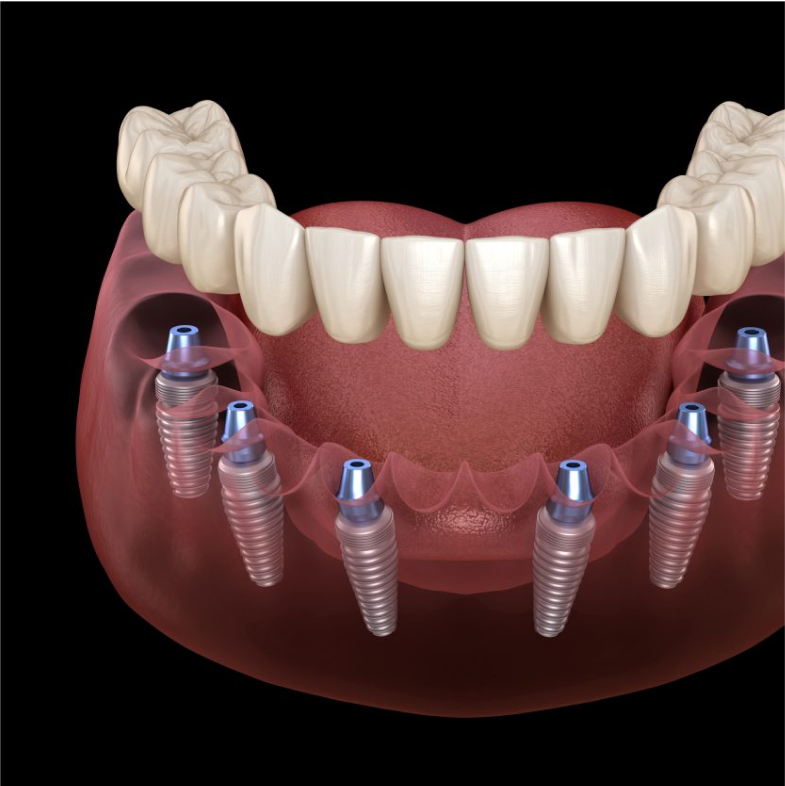 Dental Treatment
