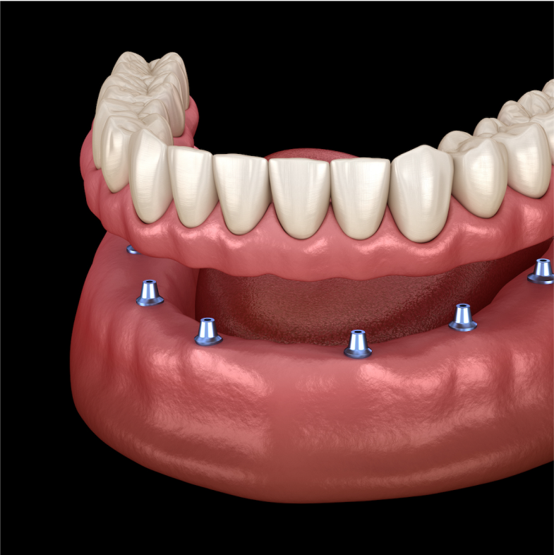 Dental Treatments
