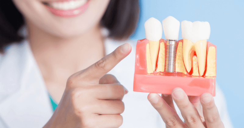 cutting-edge dental implants
