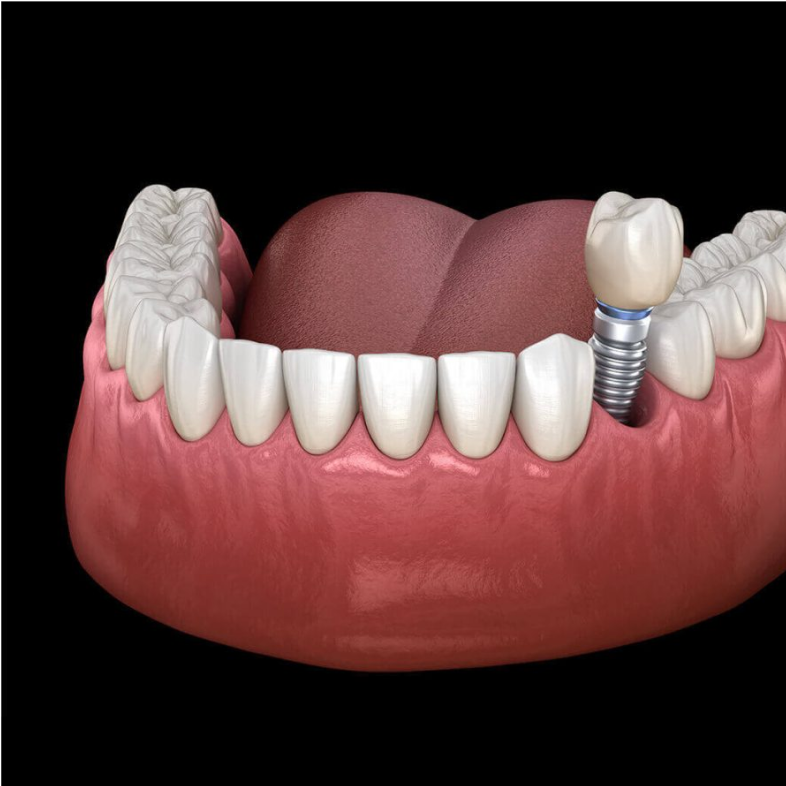 Dental Treatment