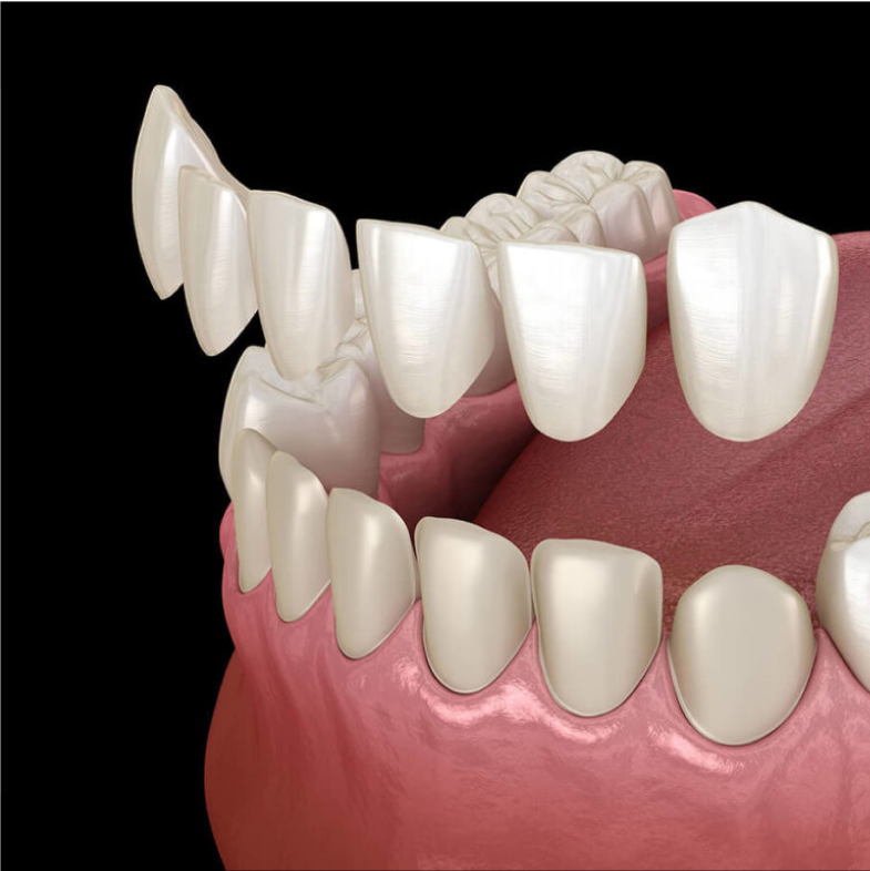 Dental Treatment